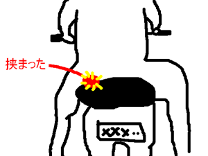 金玉が挟まった図